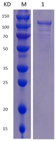 12% SDS-PAGE analysis profiles of purified MCR_RS00990-42-1000 (CBB stained).